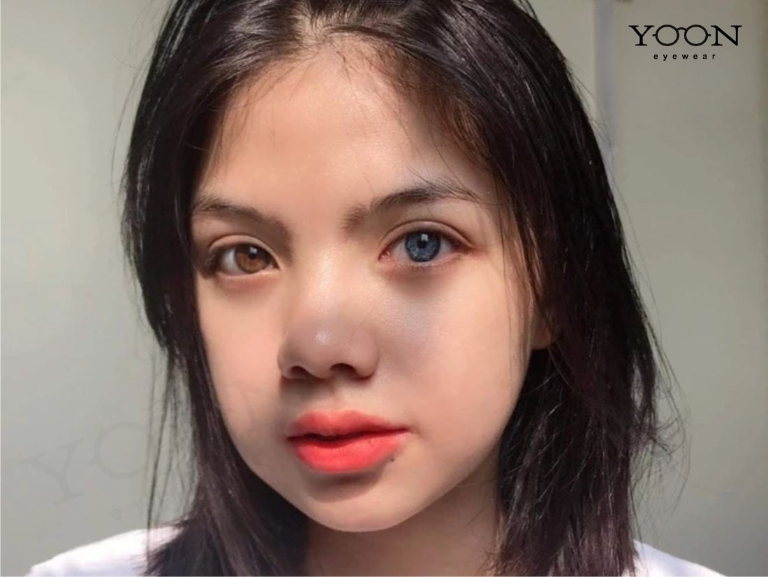 MẮT 2 MÀU LÀ GÌ?