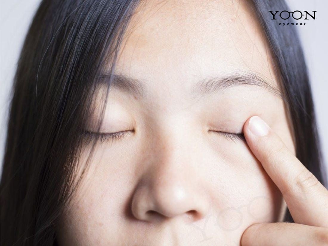 TRIỆU CHỨNG VIÊM BỜ MI TRÊN
