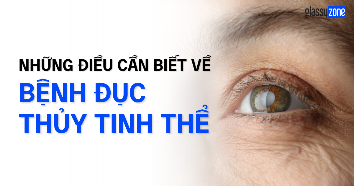 GIẢI ĐÁP THẮC MẮC VỀ ĐỤC THỦY TINH THỂ: AI CÓ NGUY CƠ VÀ CÁCH PHÒNG NGỪA