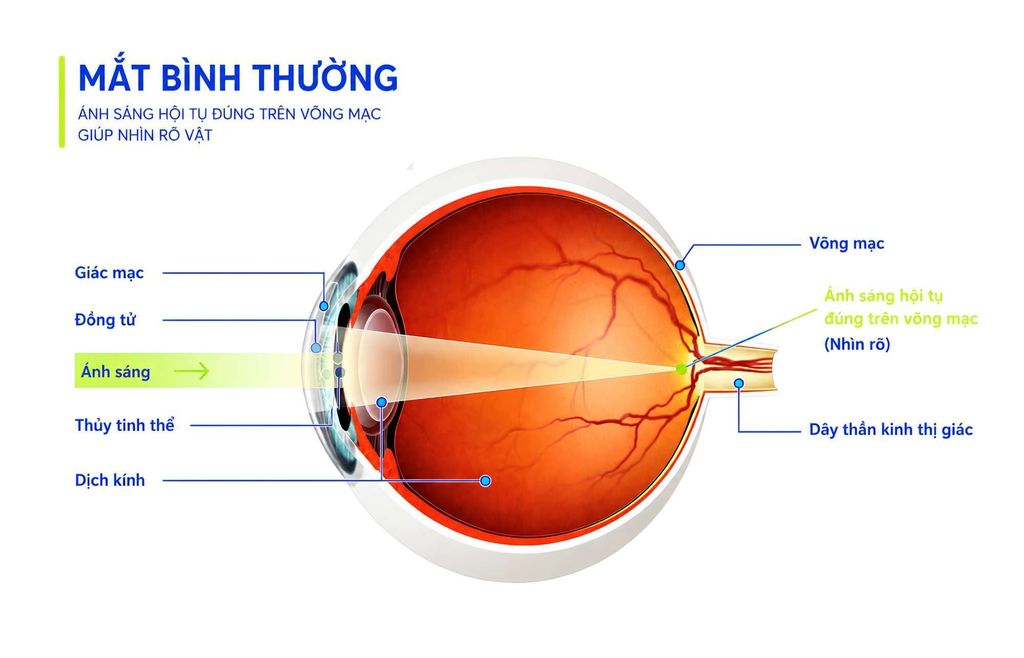 Mắt bình thường