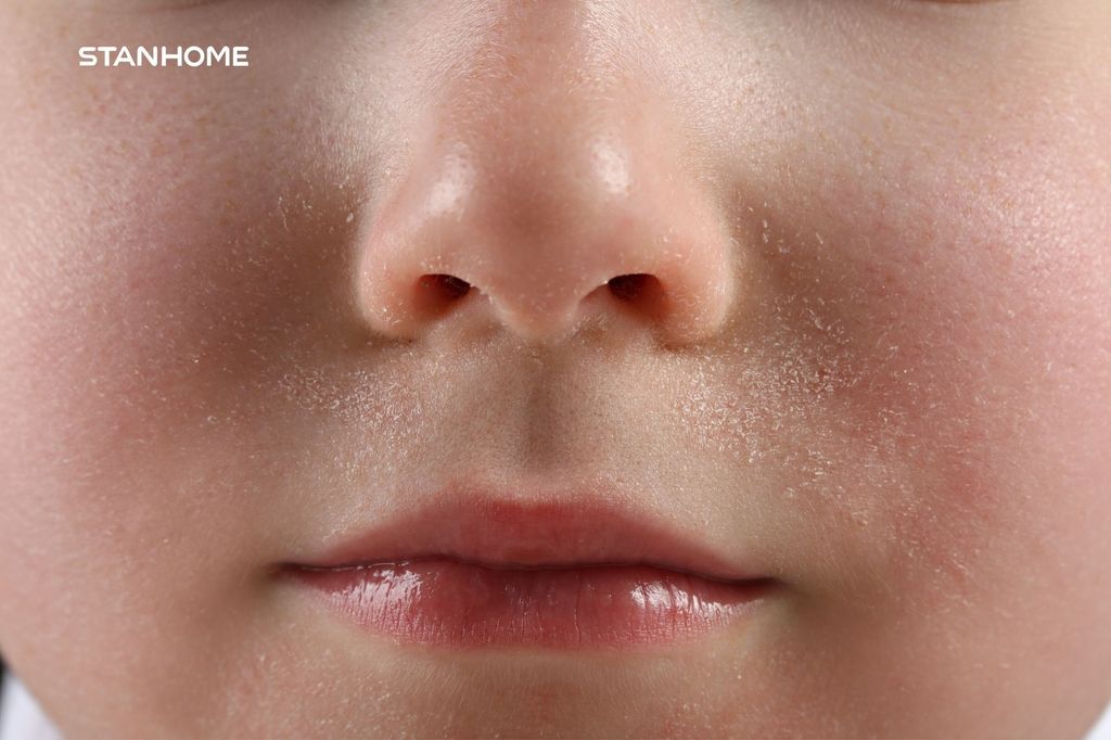 5 dấu hiệu da bạn đang thiếu ẩm mùa hanh khô