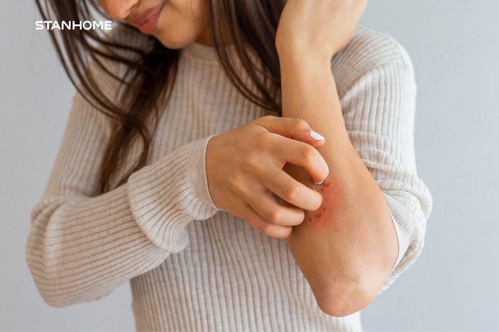 Lý do khiến da khô ngứa toàn thân và cách giảm ngứa hiệu quả