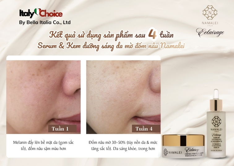 [ Feedback ] Hành trình 28 ngày cải thiện làn da U50 với combo serum và kem dưỡng sáng da Namalei