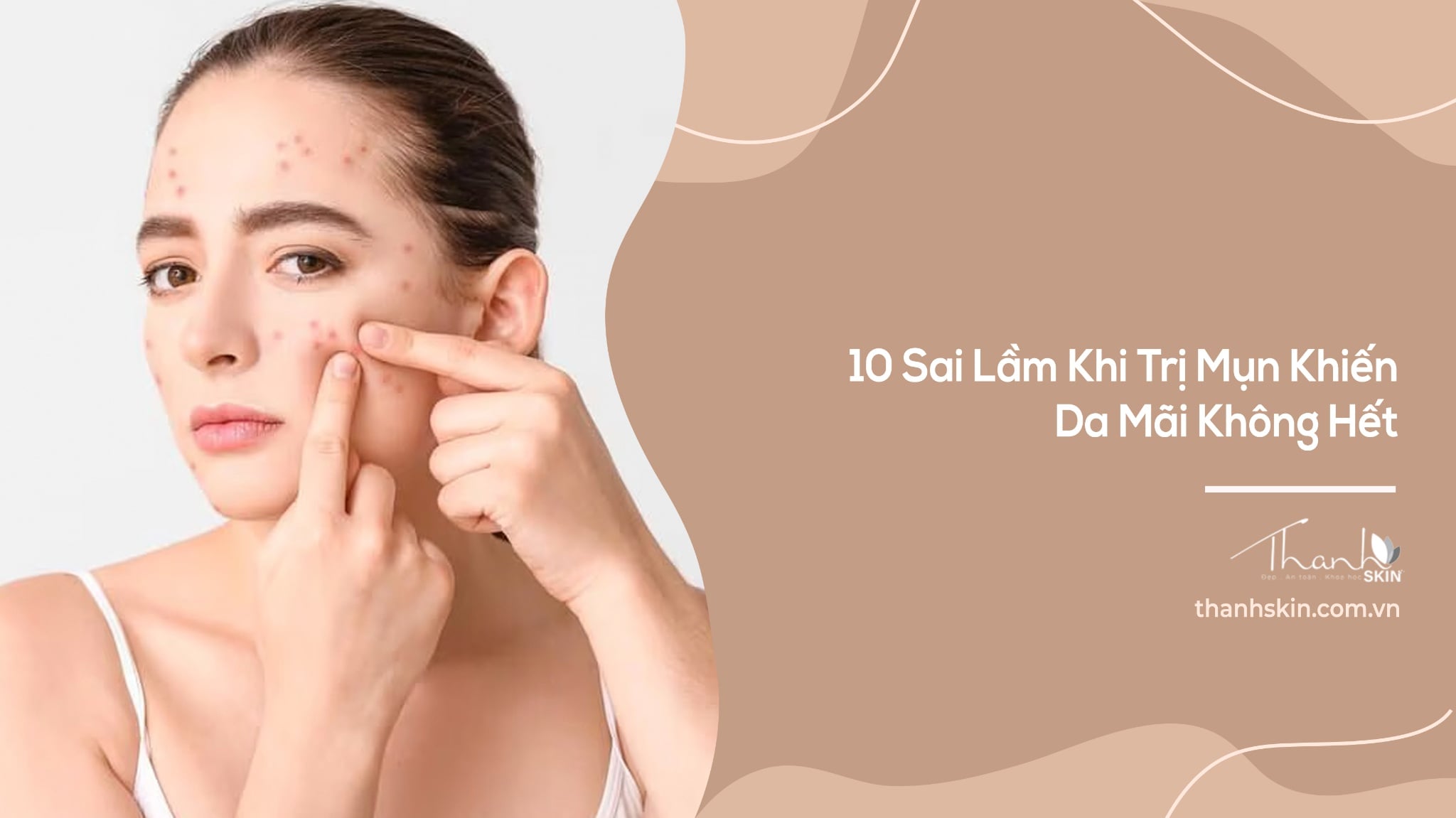 10 Sai Lầm Khi Trị Mụn Khiến Da Mãi Không Hết