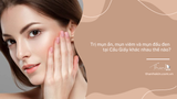 Trị mụn ẩn, mụn viêm và mụn đầu đen tại Cầu Giấy khác nhau thế nào?