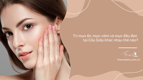 Trị mụn ẩn, mụn viêm và mụn đầu đen tại Cầu Giấy khác nhau thế nào?