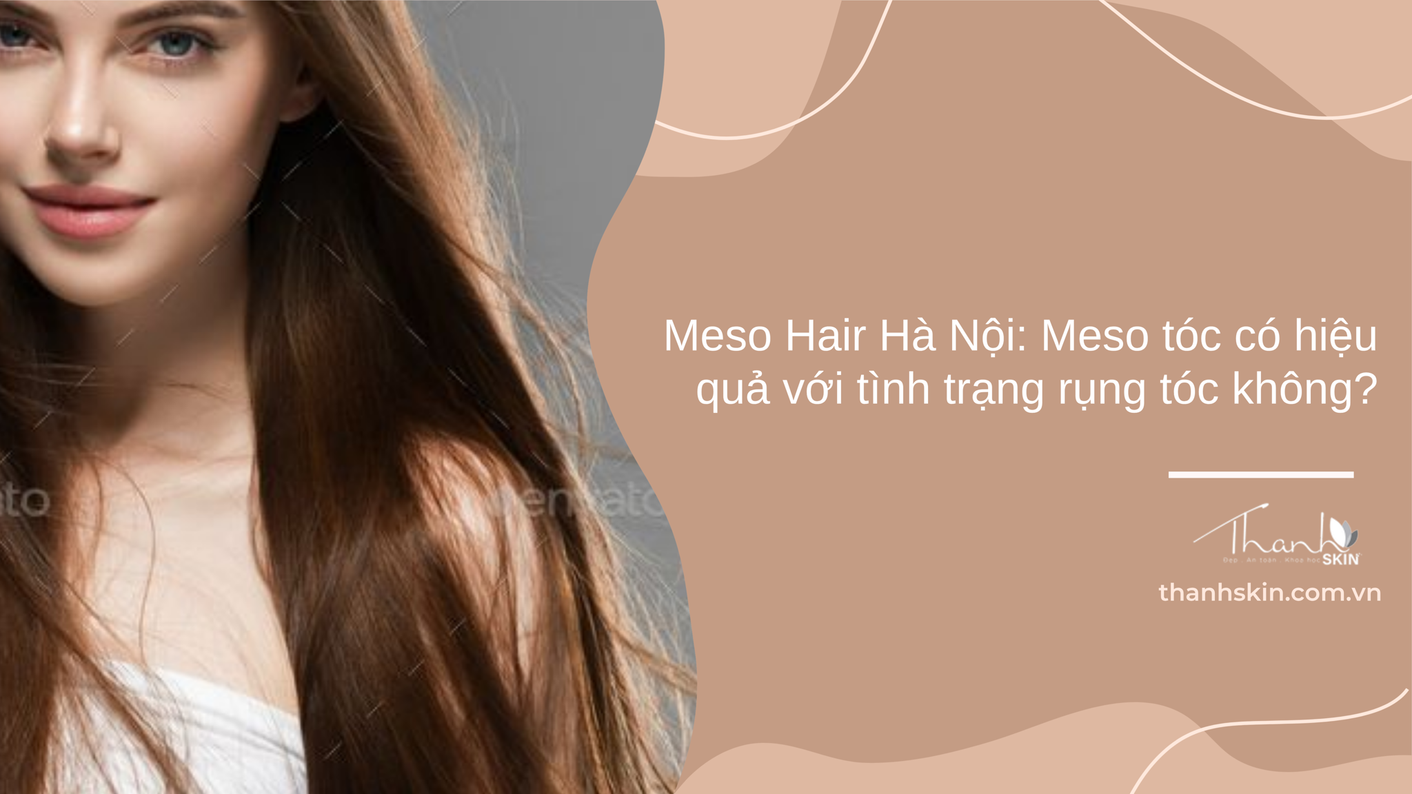 Meso Hair Hà Nội là gì? Meso tóc có hiệu quả với tình trạng rụng tóc không?