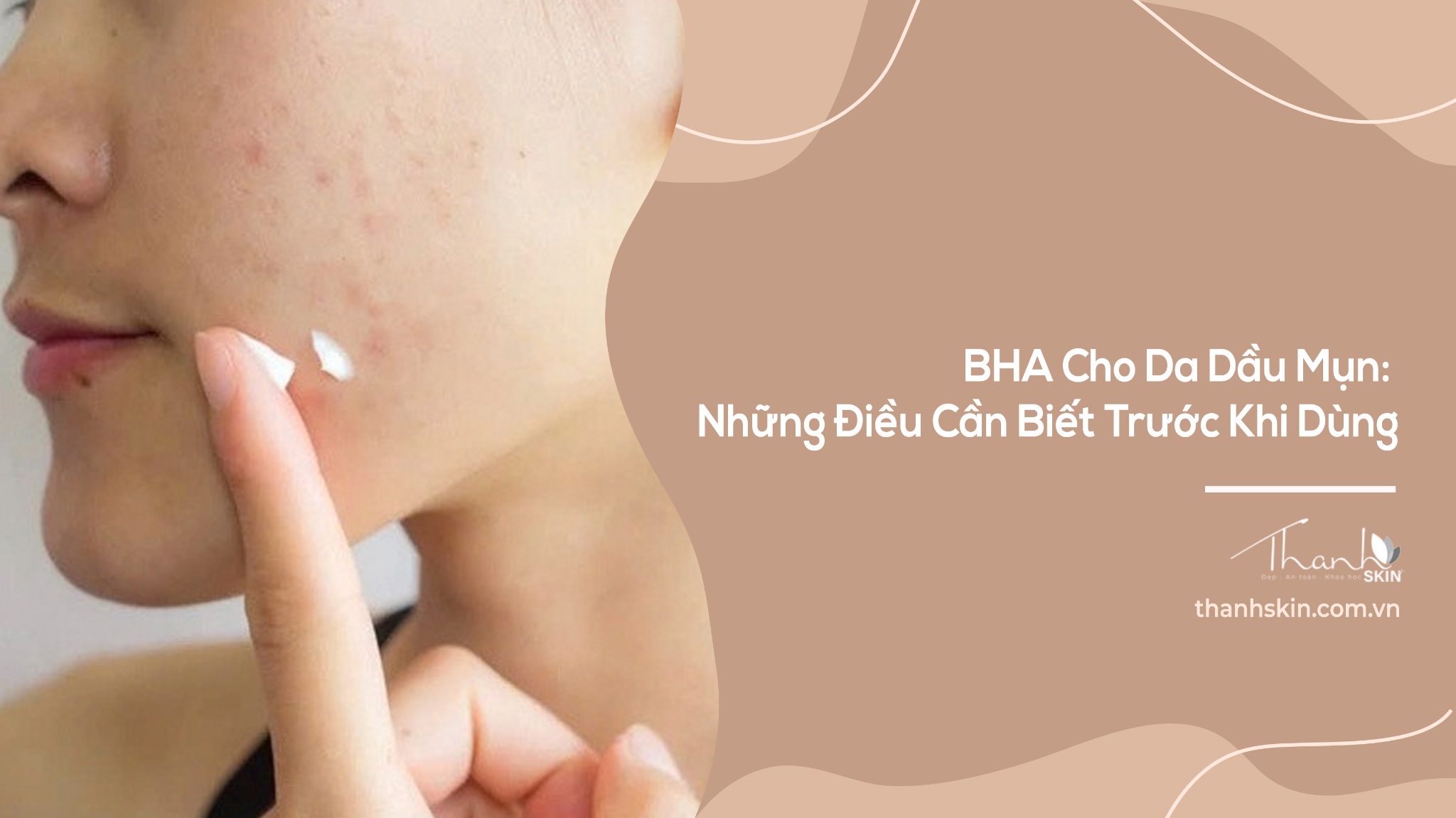 BHA Cho Da Dầu Mụn: Những Điều Cần Biết Trước Khi Dùng