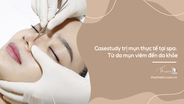 Casestudy trị mụn thực tế tại spa: Từ da mụn viêm đến da khỏe
