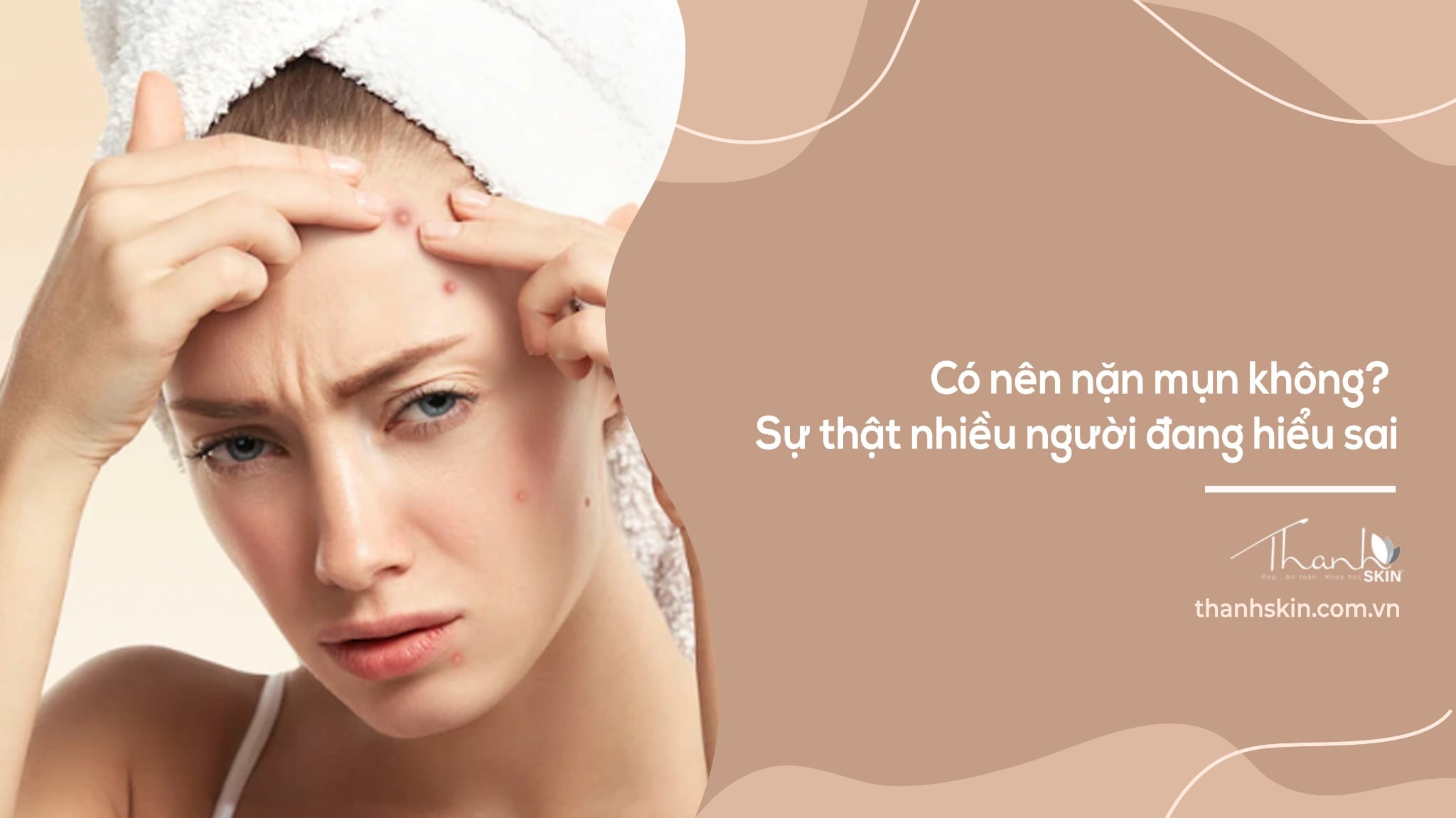 Có nên nặn mụn không? Sự thật nhiều người đang hiểu sai