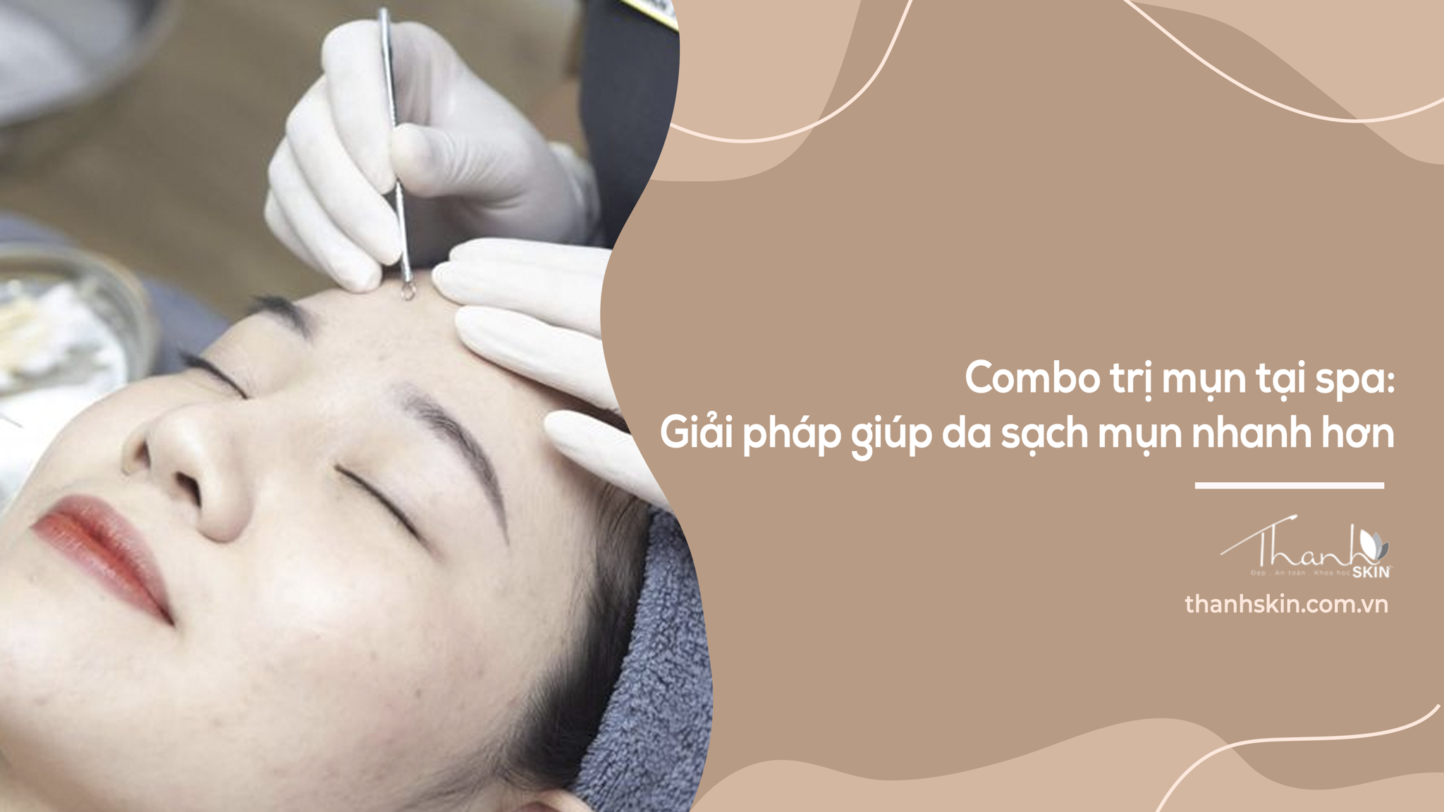 Combo trị mụn tại spa: Giải pháp tiết kiệm giúp da sạch mụn nhanh hơn