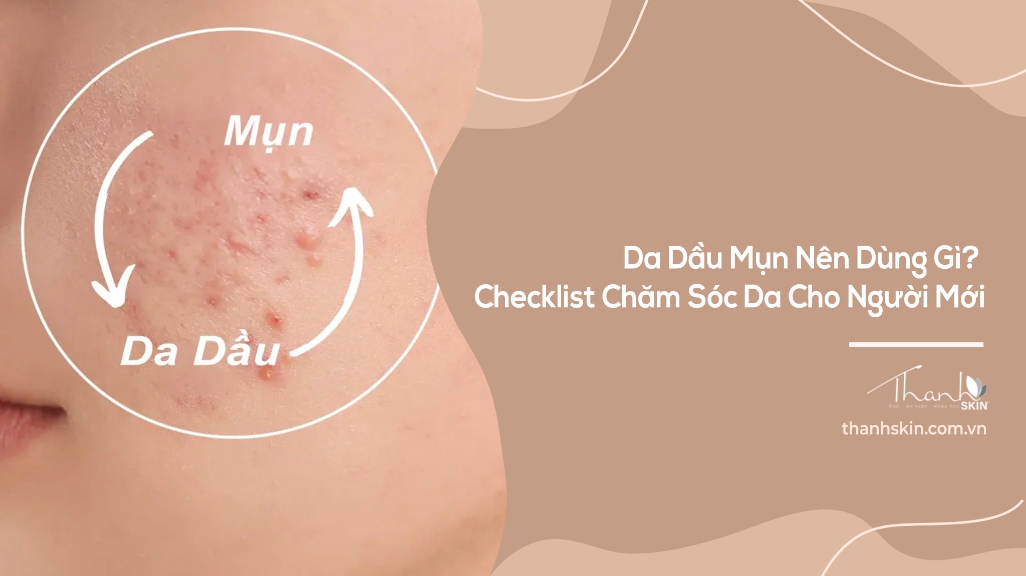 Da Dầu Mụn Nên Dùng Gì? Checklist Chăm Sóc Da Cho Người Mới