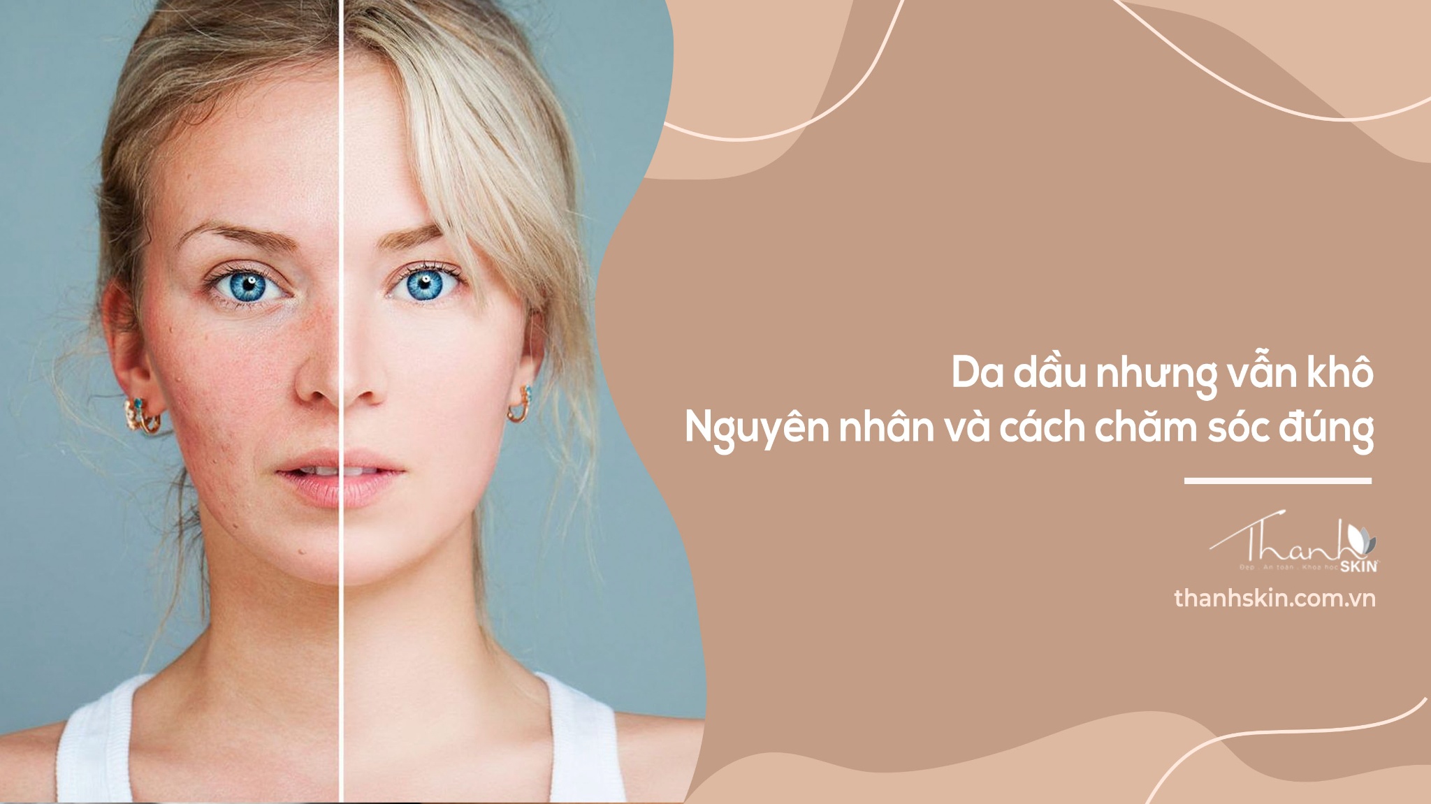 Da dầu nhưng vẫn khô – Nguyên nhân và cách chăm sóc đúng