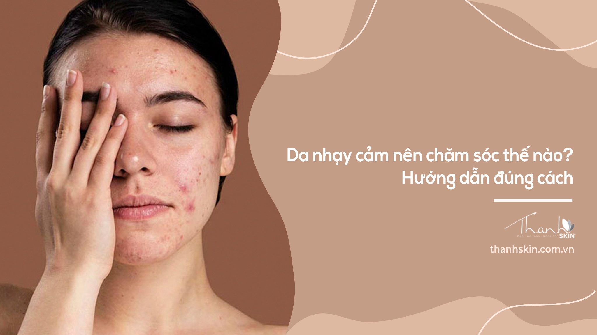 Da nhạy cảm nên chăm sóc thế nào? Hướng dẫn đúng cách