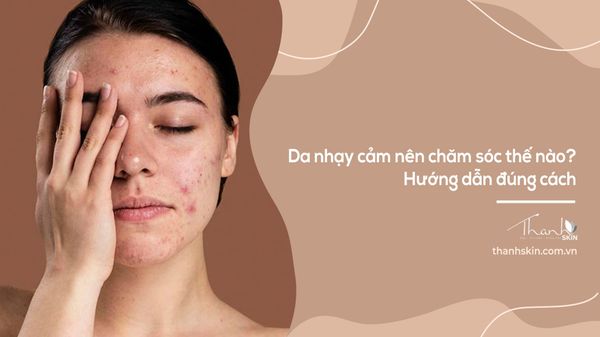 Da nhạy cảm nên chăm sóc thế nào? Hướng dẫn đúng cách
