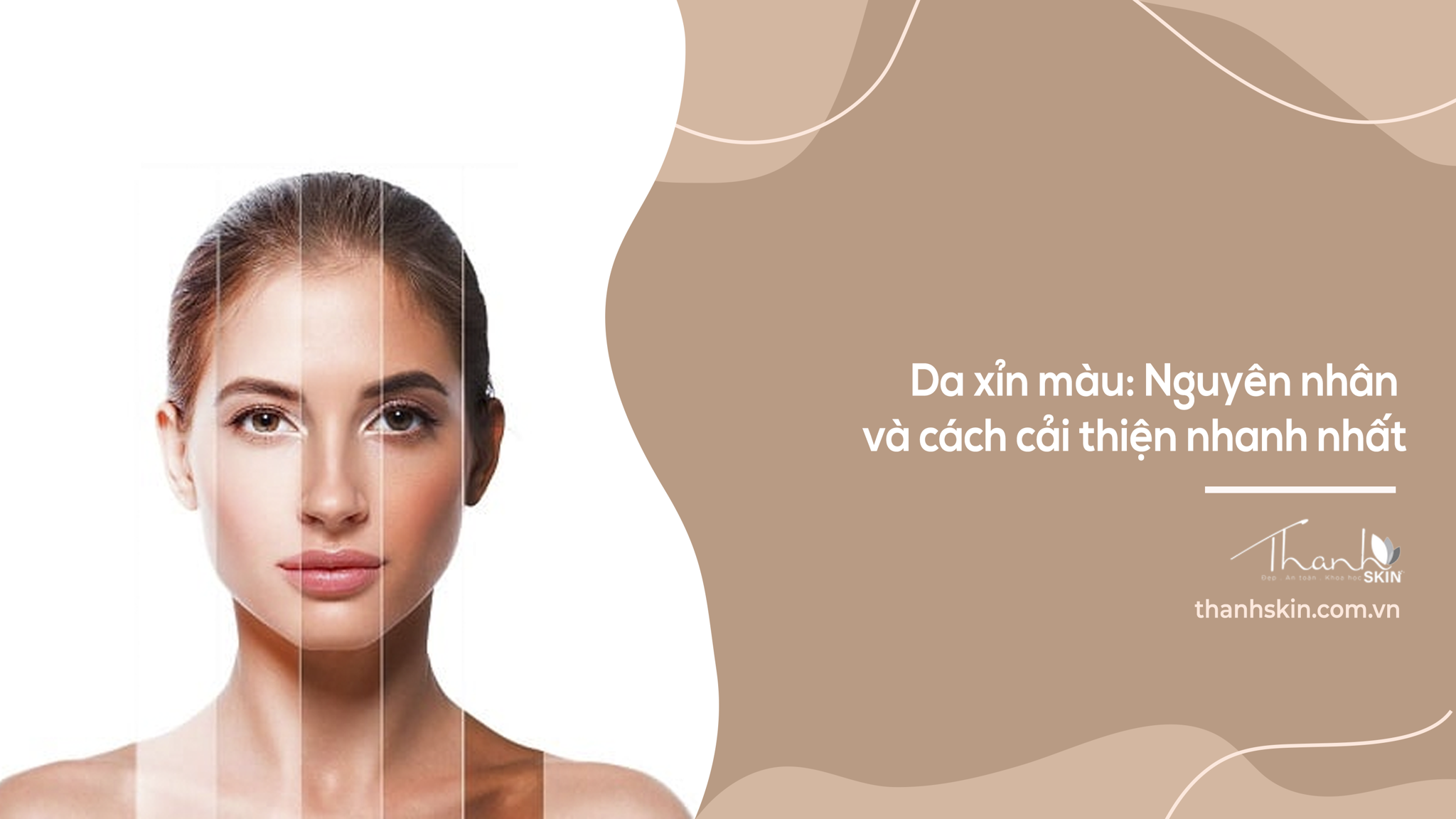 Da xỉn màu: Nguyên nhân và cách cải thiện nhanh nhất