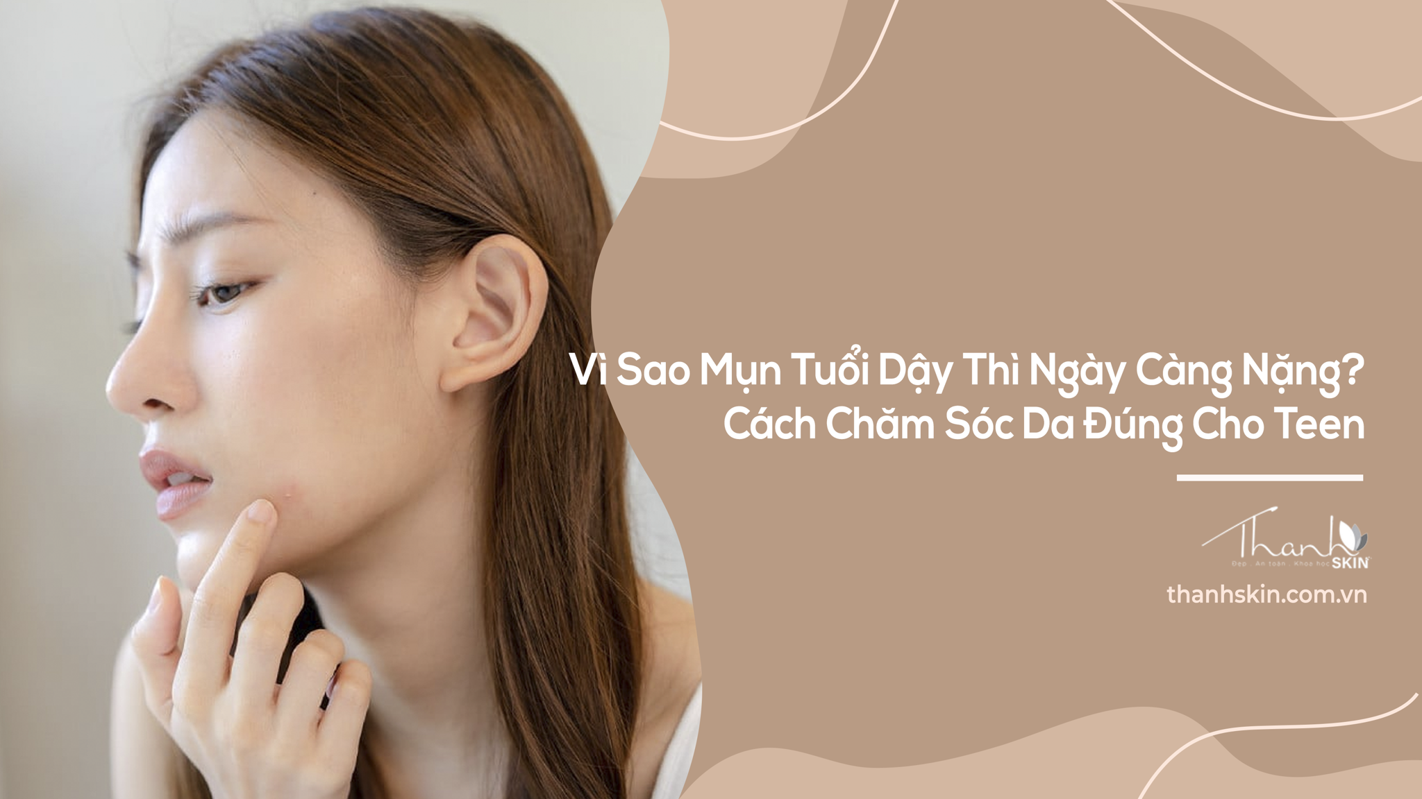 Vì Sao Mụn Tuổi Dậy Thì Ngày Càng Nặng? Cách Chăm Sóc Da Đúng Cho Teen