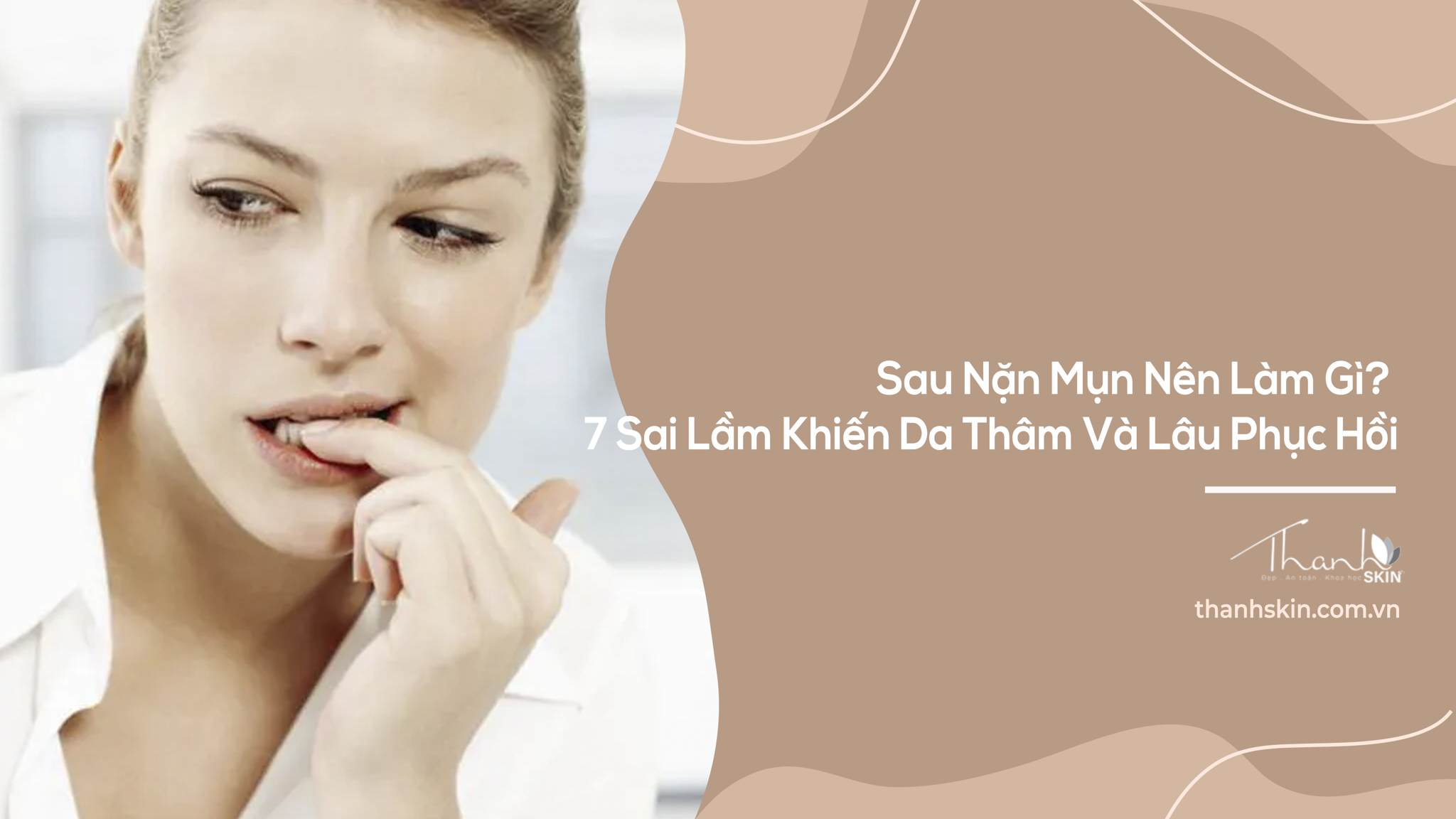 Sau Nặn Mụn Nên Làm Gì? 7 Sai Lầm Khiến Da Thâm Và Lâu Phục Hồi