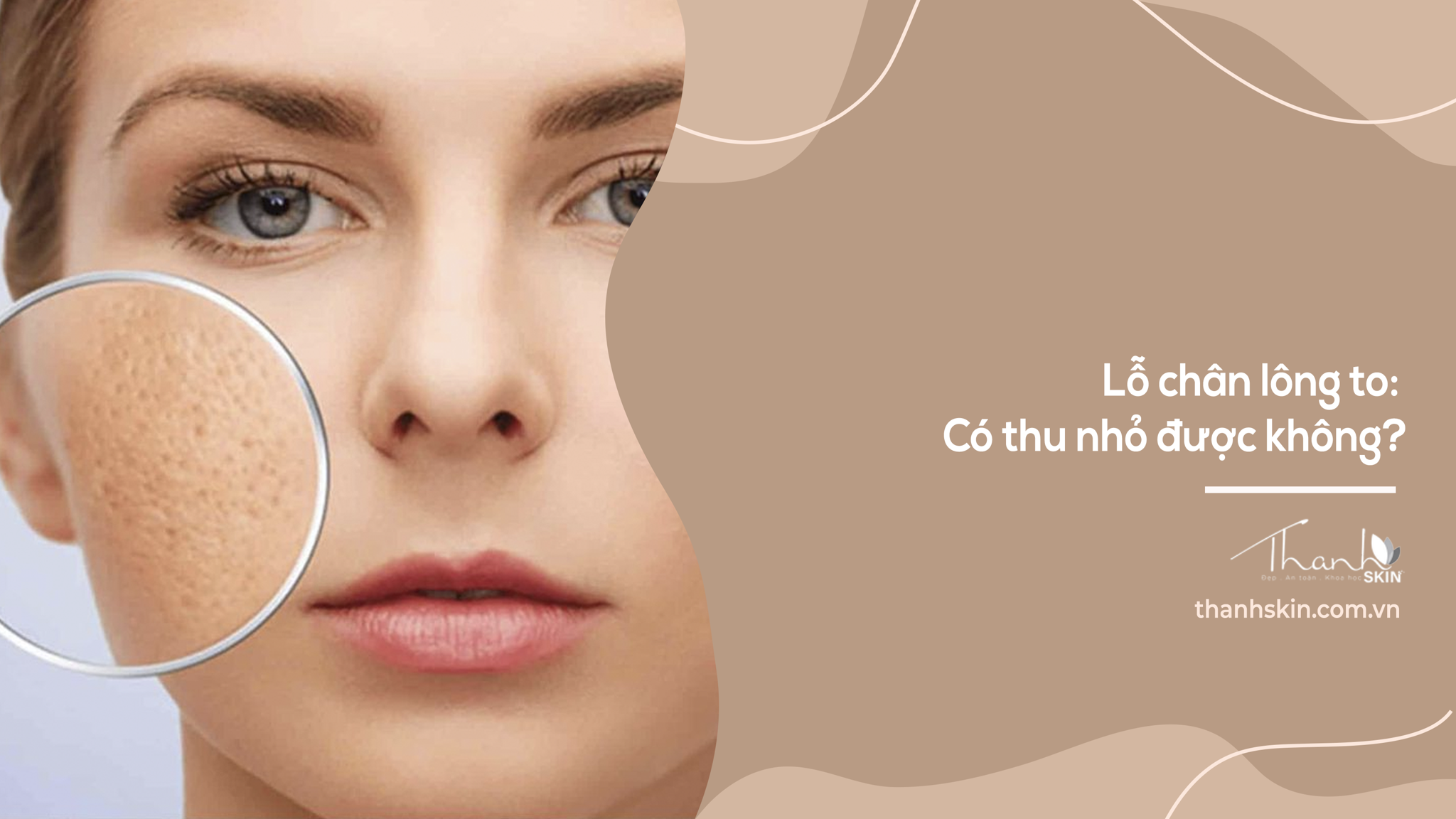 Lỗ chân lông to: Có thu nhỏ được không?