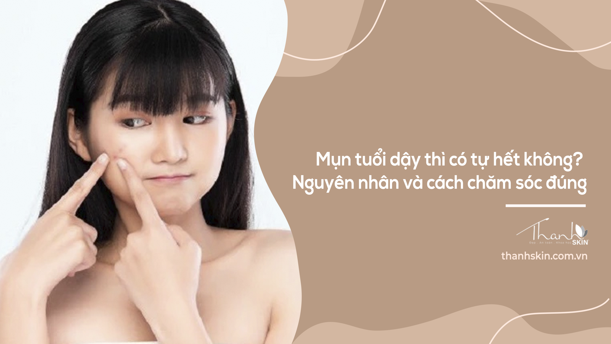 Trị Mụn Tuổi Dậy Thì: Nguyên Nhân Và Cách Chăm Sóc Đúng
