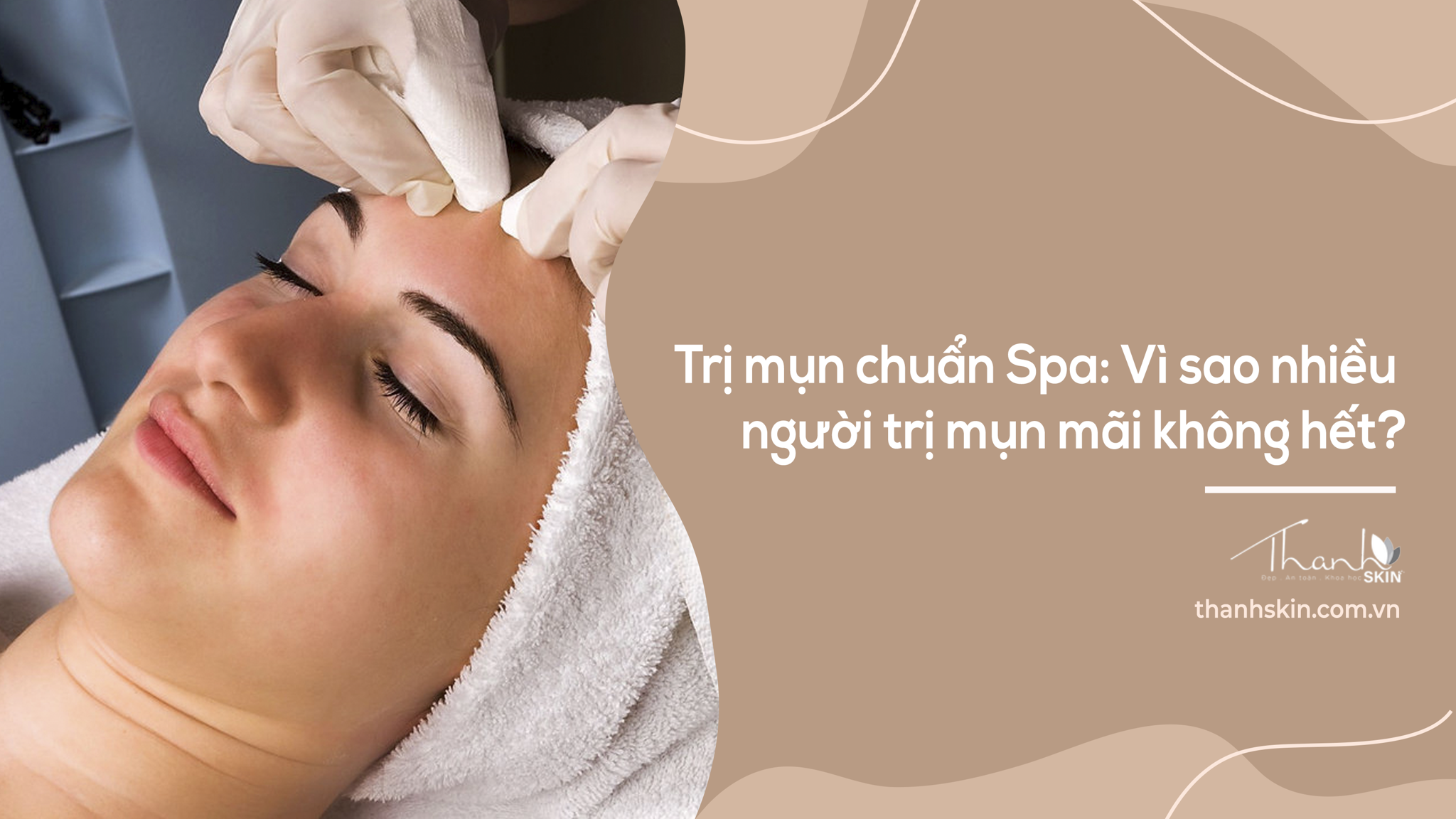 Trị mụn chuẩn spa: Vì sao nhiều người trị mụn mãi không hết?