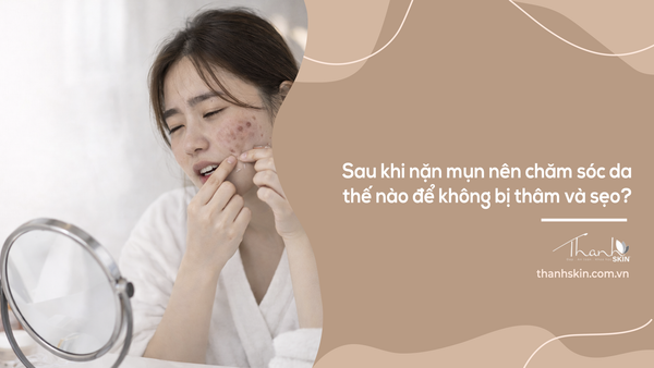 Sau khi nặn mụn nên chăm sóc da thế nào để không bị thâm và sẹo?