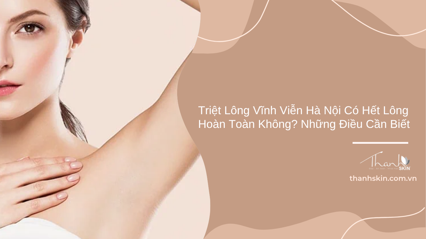 Triệt lông vĩnh viễn Hà Nội có hết lông hoàn toàn không? Những điều cần biết