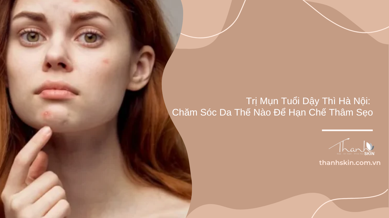 Trị mụn tuổi dậy thì Hà Nội: Chăm sóc da thế nào để hạn chế thâm sẹo?