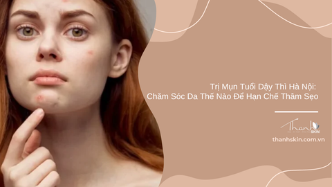 Trị mụn tuổi dậy thì Hà Nội: Chăm sóc da thế nào để hạn chế thâm sẹo?