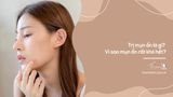 Trị mụn ẩn là gì? Vì sao mụn ẩn rất khó hết?