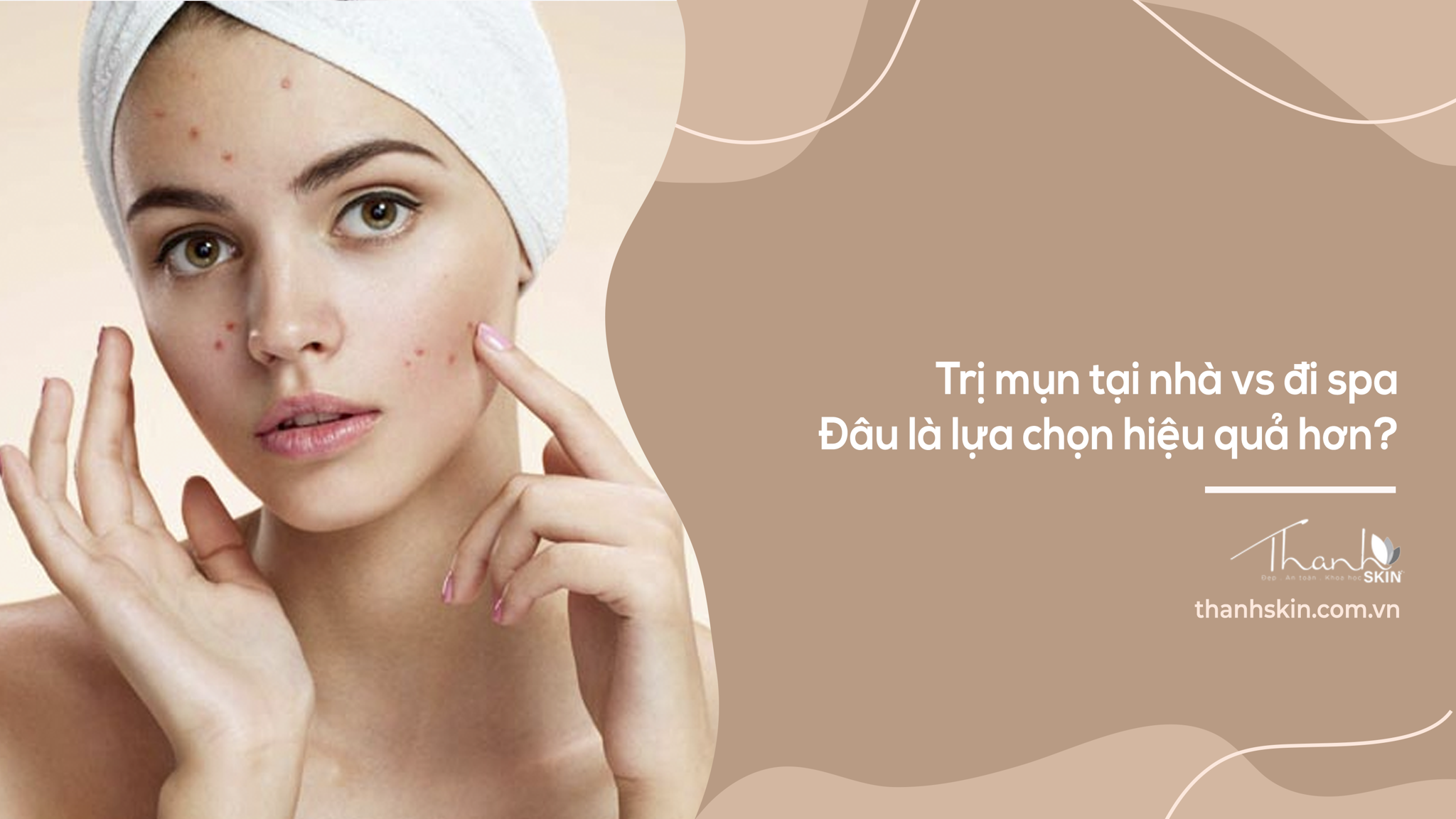Trị mụn tại nhà vs đi spa – Đâu là lựa chọn hiệu quả hơn?