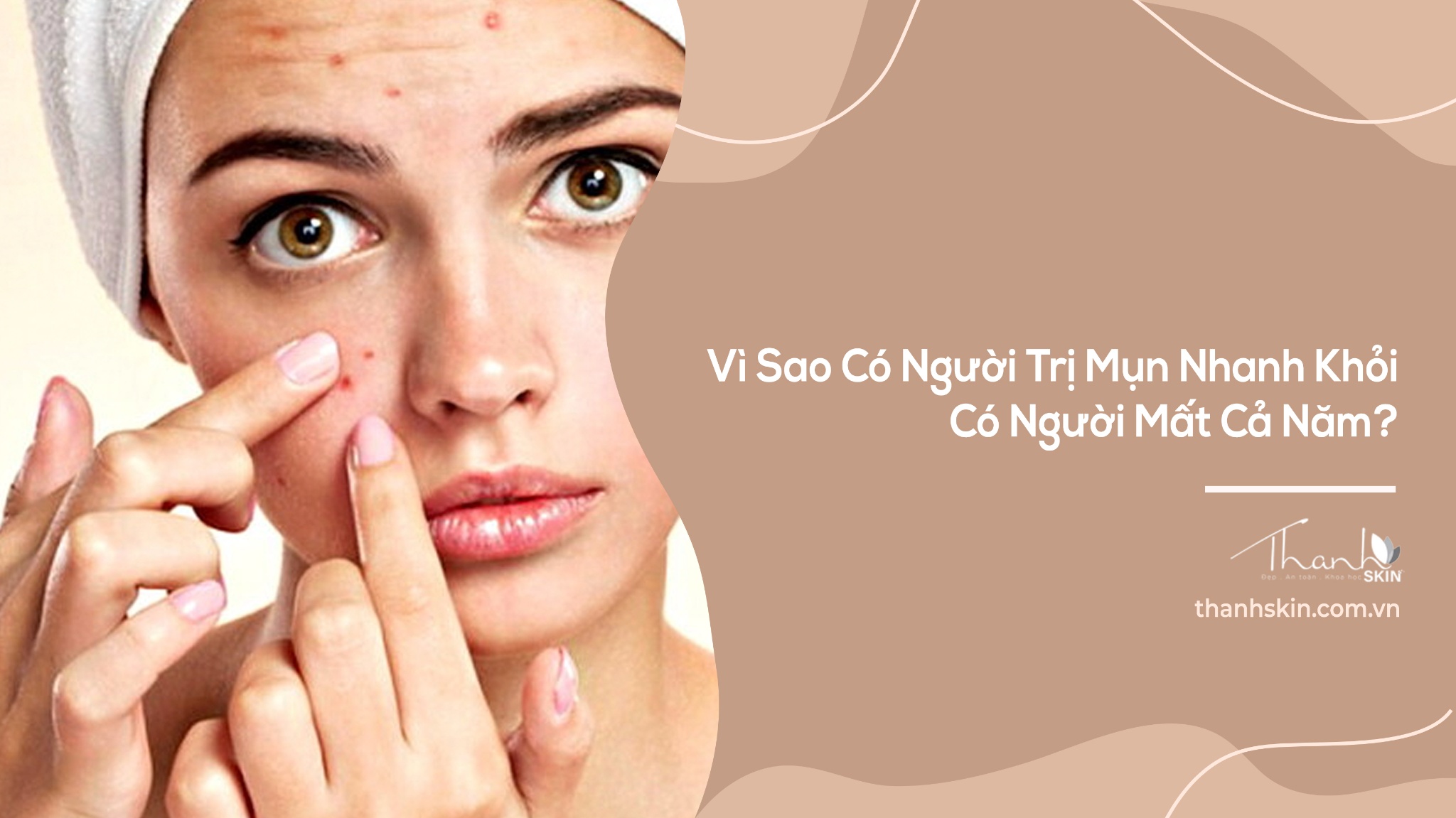 Vì Sao Có Người Trị Mụn Nhanh Khỏi, Có Người Mất Cả Năm?