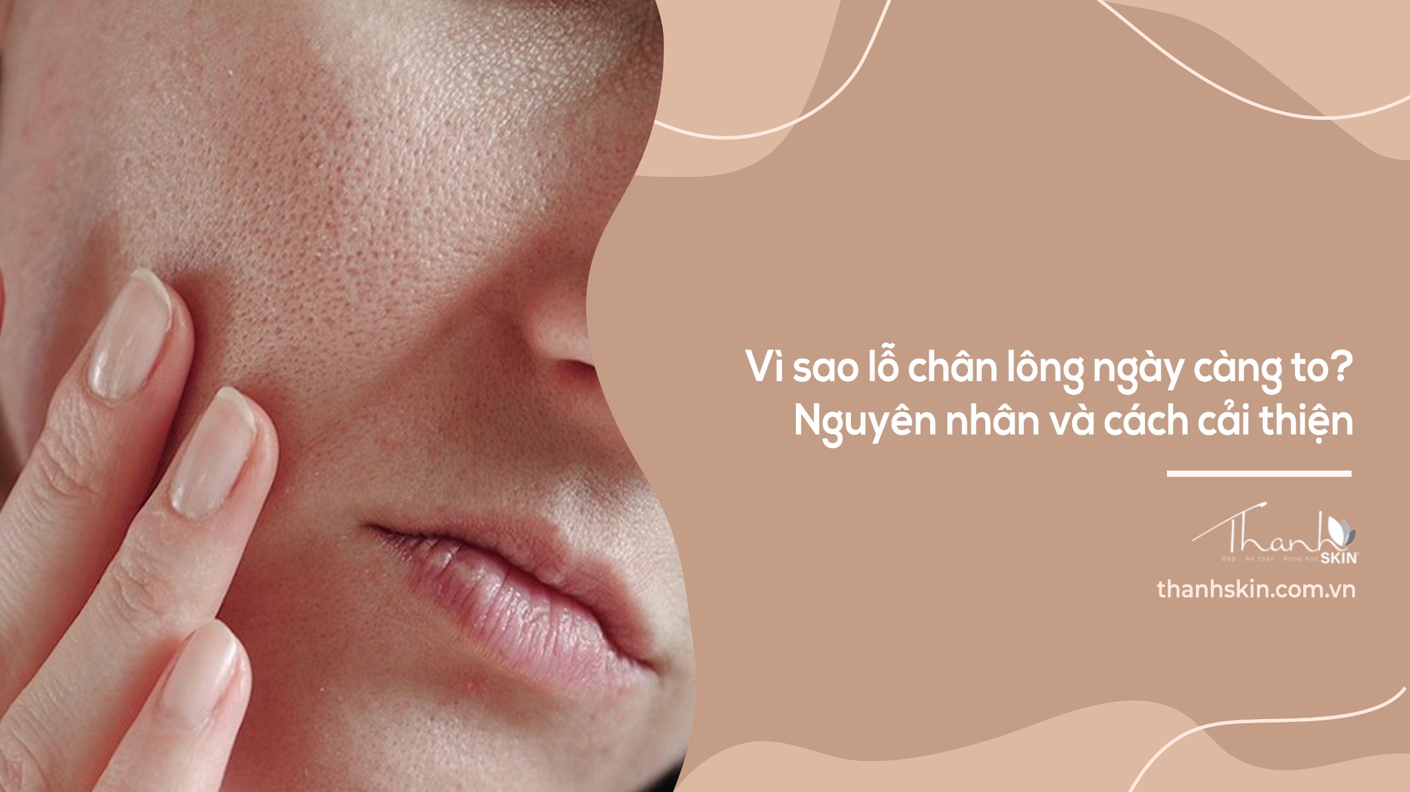 Vì sao lỗ chân lông ngày càng to? Nguyên nhân và cách cải thiện