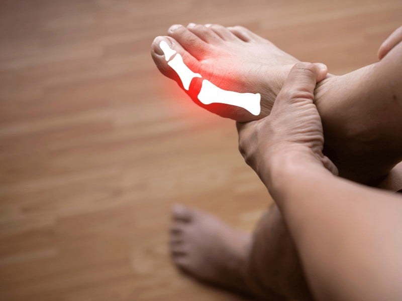 Đau ngón chân cái khi chạy bộ - Hướng dẫn chọn giày đúng cỡ