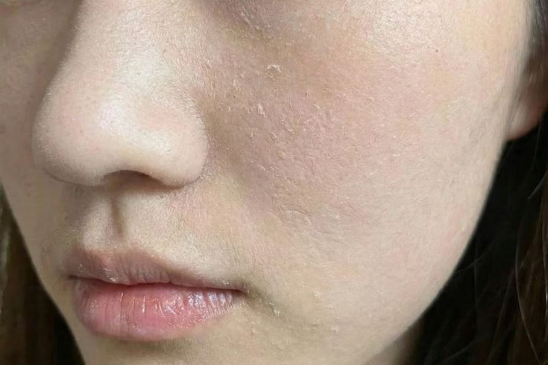 Dấu hiệu hàng rào bảo vệ da đang 