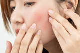 Vì sao da càng skincare càng yếu? Lý do khiến da quá tải mà nhiều người không nhận ra