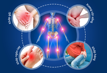 [TỔNG HỢP] 6 BÁC SĨ CHỮA XƯƠNG KHỚP CTCH GIỎI & TẬN TÂM TẠI TP.HCM