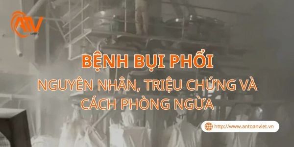 Bệnh Bụi Phổi: Nguyên Nhân, Triệu Chứng và Cách Phòng Ngừa