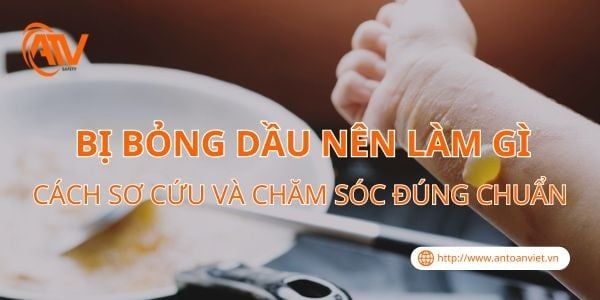 Bị Bỏng Dầu Nên Làm Gì? Cách Sơ Cứu Và Chăm Sóc Đúng Chuẩn