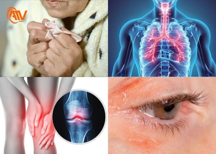 Tác hại của khí lạnh đối với cơ thể con người