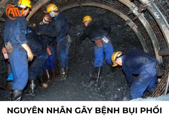 Nguyên nhân gây bệnh bụi phổi cần biết để phòng tránh kịp thời