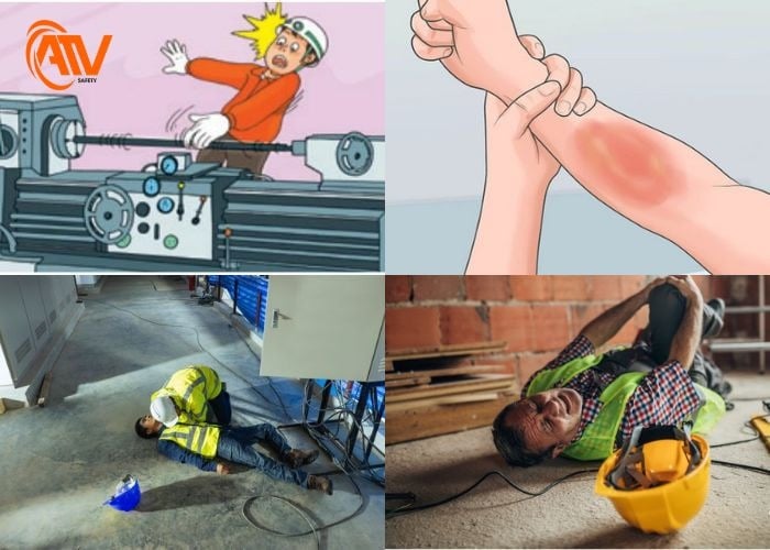 Nguy cơ tai nạn thường gặp trong môi trường sản xuất cơ khí