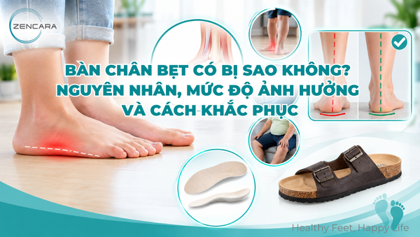 Bàn chân bẹt có bị sao không? Nguyên nhân, mức độ ảnh hưởng và cách khắc phục