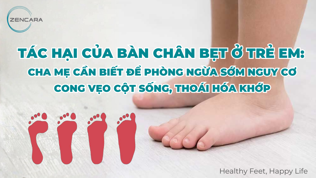 Tác hại của bàn chân bẹt ở trẻ em: Cha mẹ cần biết để phòng ngừa sớm nguy cơ cong vẹo cột sống, thoái hóa khớp