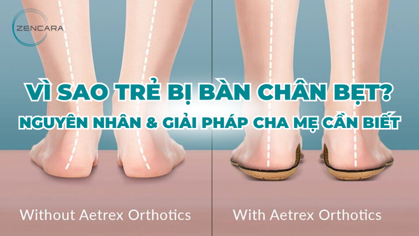 Vì sao trẻ bị bàn chân bẹt? Nguyên nhân & giải pháp cha mẹ cần biết