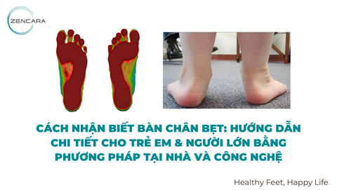 Cách nhận biết bàn chân bẹt: Hướng dẫn chi tiết cho trẻ em & người lớn bằng phương pháp tại nhà và công nghệ