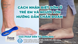Triệu chứng bàn chân bẹt: Cách nhận biết sớm ở trẻ em và người lớn, hướng dẫn chẩn đoán và giải pháp đến từ Zencara