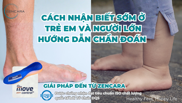 Triệu chứng bàn chân bẹt: Cách nhận biết sớm ở trẻ em và người lớn, hướng dẫn chẩn đoán và giải pháp đến từ Zencara