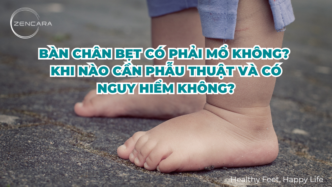 Bàn chân bẹt có phải mổ không? Khi nào cần phẫu thuật và có nguy hiểm không?