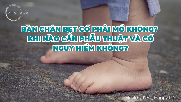 Bàn chân bẹt có phải mổ không? Khi nào cần phẫu thuật và có nguy hiểm không?